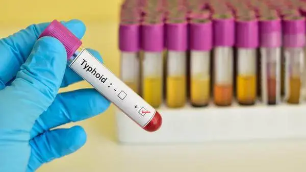 Typhoid Surge in Oti Demands Immediate Action